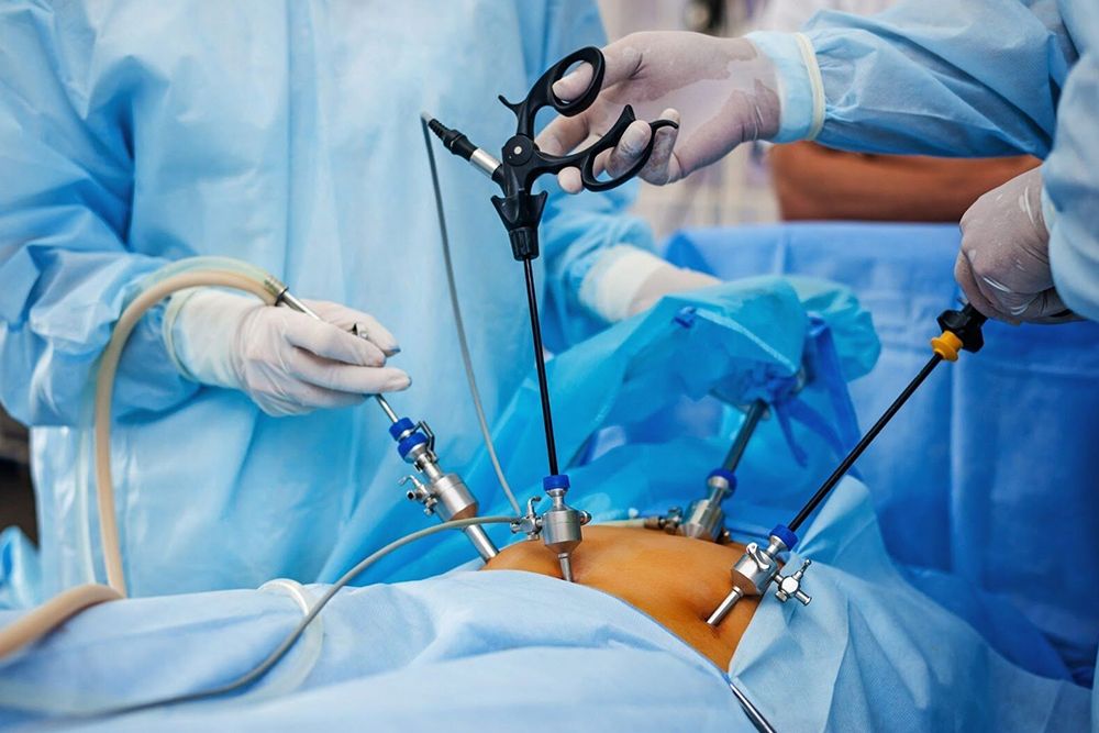 Laparoscopic Surgery Laparoscopic Surgery